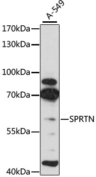 SPRTN / C1orf124 Antibody - Western blot analysis of extracts of A-549 cells, using SPRTN antibody at 1:3000 dilution. The secondary antibody used was an HRP Goat Anti-Rabbit IgG (H+L) at 1:10000 dilution. Lysates were loaded 25ug per lane and 3% nonfat dry milk in TBST was used for blocking. An ECL Kit was used for detection and the exposure time was 30s.