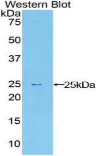 SPRY1 / Sprouty 1 Antibody - Western blot of recombinant SPRY1 / Sprouty 1.  This image was taken for the unconjugated form of this product. Other forms have not been tested.