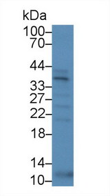SPRY1 / Sprouty 1 Antibody - Western Blot; Sample: Human Serum; Primary Ab: 5µg/ml Rabbit Anti-Human SPRY1 Antibody Second Ab: 0.2µg/mL HRP-Linked Caprine Anti-Rabbit IgG Polyclonal Antibody
