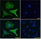 SPRY1 / Sprouty 1 Antibody - SPRY1 / Sprouty 1 antibody immunofluorescence analysis of paraformaldehyde fixed HeLa cells, permeabilized with 0.15% Triton. Primary incubation 1hr (10ug/ml) followed by Alexa Fluor 488 secondary antibody (4ug/ml), showing cytoplasmic and Golgi apparatus staining. The nuclear stain is DAPI (blue). Negative control: Unimmunized goat IgG (10ug/ml) followed by Alexa Fluor 488 secondary antibody (4ug/ml).