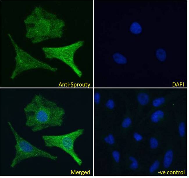 SPRY1 / Sprouty 1 Antibody - SPRY1 / Sprouty 1 antibody immunofluorescence analysis of paraformaldehyde fixed HeLa cells, permeabilized with 0.15% Triton. Primary incubation 1hr (10ug/ml) followed by Alexa Fluor 488 secondary antibody (4ug/ml), showing cytoplasmic and Golgi apparatus staining. The nuclear stain is DAPI (blue). Negative control: Unimmunized goat IgG (10ug/ml) followed by Alexa Fluor 488 secondary antibody (4ug/ml).