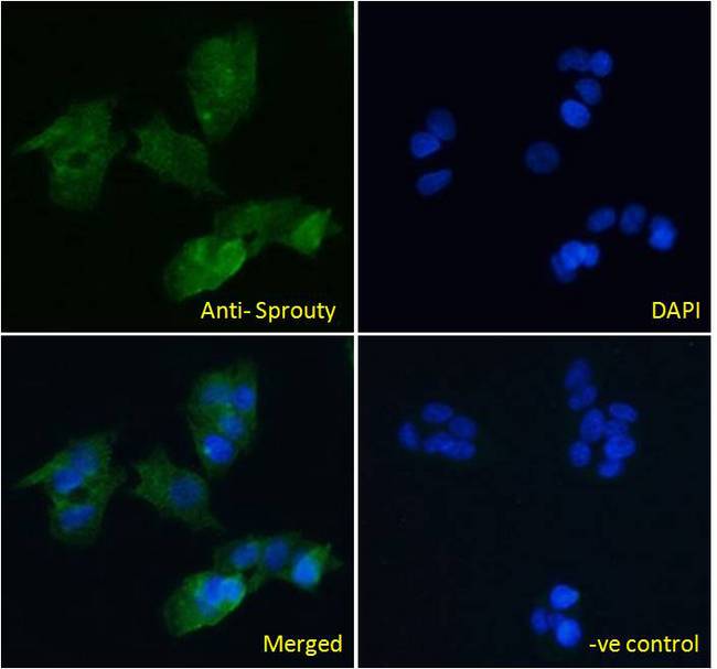 SPRY1 / Sprouty 1 Antibody - SPRY1 / Sprouty 1 antibody immunofluorescence analysis of paraformaldehyde fixed HepG2 cells, permeabilized with 0.15% Triton. Primary incubation 1hr (10ug/ml) followed by Alexa Fluor 488 secondary antibody (4ug/ml), showing cytoplasmic and Golgi apparatus staining. The nuclear stain is DAPI (blue). Negative control: Unimmunized goat IgG (10ug/ml) followed by Alexa Fluor 488 secondary antibody (4ug/ml).