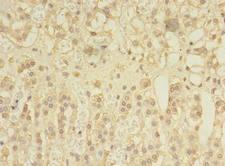 SPRY1 / Sprouty 1 Antibody - Immunohistochemistry of paraffin-embedded human adrenal gland tissue using antibody at dilution of 1:100.
