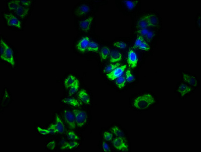 SPRY1 / Sprouty 1 Antibody - Immunofluorescence staining of PC3 cells with SPRY1 Antibody at 1:266, counter-stained with DAPI. The cells were fixed in 4% formaldehyde, permeabilized using 0.2% Triton X-100 and blocked in 10% normal Goat Serum. The cells were then incubated with the antibody overnight at 4°C. The secondary antibody was Alexa Fluor 488-congugated AffiniPure Goat Anti-Rabbit IgG(H+L).