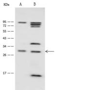 SPRY1 / Sprouty 1 Antibody - Anti-SPRY1 rabbit polyclonal antibody at 1:500 dilution. Lane A: HepG2 Whole Cell Lysate. Lane B: HeLa Whole Cell Lysate. Lysates/proteins at 30 ug per lane. Secondary: Goat Anti-Rabbit IgG (H+L)/HRP at 1/10000 dilution. Developed using the ECL technique. Performed under reducing conditions. Predicted band size: 35 kDa.