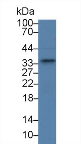 SPRY2 / Sprouty 2 Antibody - Western Blot; Sample: Human A375 cell lysate; Primary Ab: 2µg/ml Rabbit Anti-Rat SPRY2 Antibody Second Ab: 0.2µg/mL HRP-Linked Caprine Anti-Rabbit IgG Polyclonal Antibody
