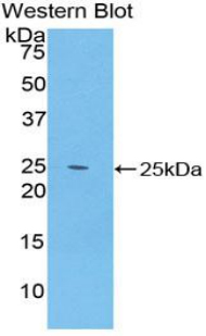 SPRY2 / Sprouty 2 Antibody - Western blot of recombinant SPRY2 / Sprouty 2.  This image was taken for the unconjugated form of this product. Other forms have not been tested.