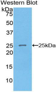SPRY2 / Sprouty 2 Antibody - Western blot of recombinant SPRY2 / Sprouty 2.  This image was taken for the unconjugated form of this product. Other forms have not been tested.