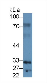 SPRY2 / Sprouty 2 Antibody - Western Blot; Sample: Human Lung lysate; Primary Ab: 3µg/ml Rabbit Anti-Human SPRY2 Antibody Second Ab: 0.2µg/mL HRP-Linked Caprine Anti-Rabbit IgG Polyclonal Antibody