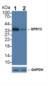 SPRY2 / Sprouty 2 Antibody - Knockout Varification: Lane 1: Wild-type A375 cell lysate; Lane 2: SPRY2 knockout A375 cell lysate; Predicted MW: 35kd Observed MW: 35kd Primary Ab: 1µg/ml Rabbit Anti-Human SPRY2 Antibody Second Ab: 0.2µg/mL HRP-Linked Caprine Anti-Rabbit IgG Polyclonal Antibody