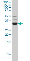 SPRY2 / Sprouty 2 Antibody - SPRY2 monoclonal antibody (M01), clone 1E10 Western blot of SPRY2 expression in C32.