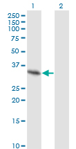 SPRY2 / Sprouty 2 Antibody - Western blot of SPRY2 expression in transfected 293T cell line by SPRY2 monoclonal antibody (M01), clone 1E10.