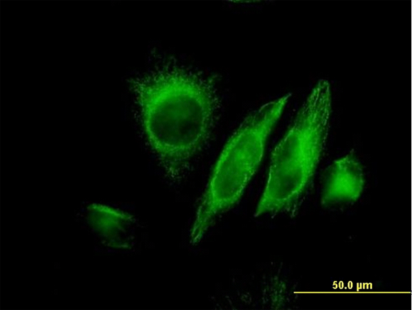 SPRY2 / Sprouty 2 Antibody - Immunofluorescence of monoclonal antibody to SPRY2 on HeLa cell. [antibody concentration 25 ug/ml]