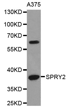 SPRY2 / Sprouty 2 Antibody - Western blot analysis of extracts of A375 cells.