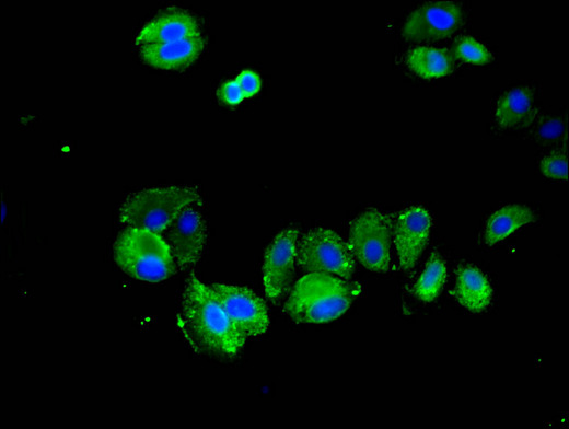 SPRY2 / Sprouty 2 Antibody - Immunofluorescent analysis of HepG2 cells using SPRY2 Antibody at a dilution of 1:100 and Alexa Fluor 488-congugated AffiniPure Goat Anti-Rabbit IgG(H+L)