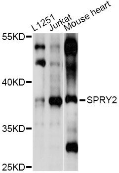 SPRY2 / Sprouty 2 Antibody - Western blot analysis of extracts of various cell lines, using SPRY2 antibody at 1:1000 dilution. The secondary antibody used was an HRP Goat Anti-Rabbit IgG (H+L) at 1:10000 dilution. Lysates were loaded 25ug per lane and 3% nonfat dry milk in TBST was used for blocking. An ECL Kit was used for detection and the exposure time was 10s.