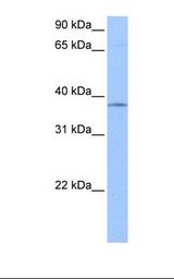 SPRY2 / Sprouty 2 Antibody - HepG2 cell lysate. Antibody concentration: 1.0 ug/ml. Gel concentration: 12%.  This image was taken for the unconjugated form of this product. Other forms have not been tested.