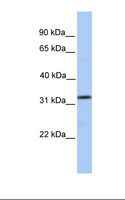 SPRY3 / Sprouty 3 Antibody - Fetal brain lysate. Antibody concentration: 1.0 ug/ml. Gel concentration: 12%.  This image was taken for the unconjugated form of this product. Other forms have not been tested.