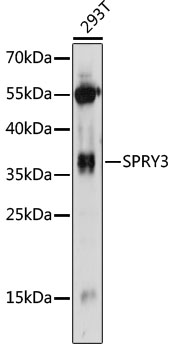 SPRY3 / Sprouty 3 Antibody - Western blot analysis of extracts of 293T cells, using SPRY3 antibody at 1:1000 dilution. The secondary antibody used was an HRP Goat Anti-Rabbit IgG (H+L) at 1:10000 dilution. Lysates were loaded 25ug per lane and 3% nonfat dry milk in TBST was used for blocking. An ECL Kit was used for detection and the exposure time was 60s.
