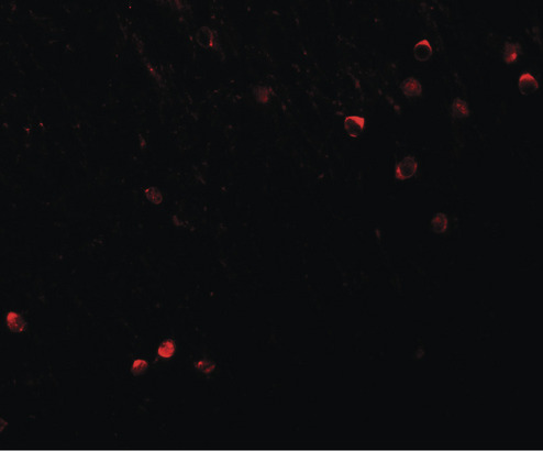 SPRYD3 Antibody - Immunofluorescence of SPRYD3 in mouse brain tissue with SPRYD3 antibody at 20 ug/ml.