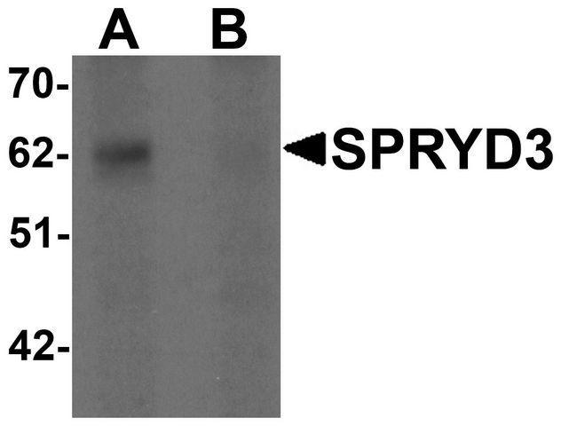 SPRYD3 Antibody - Western blot analysis of SPRYD3 in human brain tissue lysate with SPRYD3 antibody at 1 ug/ml in (A) the absence and (B) the presence of blocking peptide