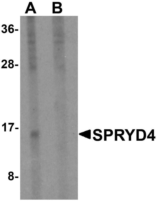 SPRYD4 Antibody - Western blot analysis of SPRYD4 in mouse kidney tissue lysate with SPRYD4 antibody at 1 ug/ml in (A) the absence and (B) the presence of blocking peptide