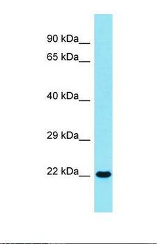 SPRYD4 Antibody - Western blot of Human HT1080. SPRYD4 antibody dilution 1.0 ug/ml.  This image was taken for the unconjugated form of this product. Other forms have not been tested.