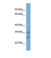 SPRYD5 Antibody - Western blot of Human 293T. TRIM51 antibody dilution 1.0 ug/ml.  This image was taken for the unconjugated form of this product. Other forms have not been tested.