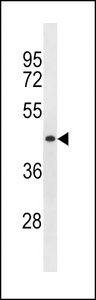 SPRYD5 Antibody - SPRYD5 Antibody western blot of MDA-MB231 cell line lysates (35 ug/lane). The SPRYD5 antibody detected the SPRYD5 protein (arrow).