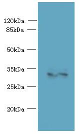 SPRYD5 Antibody - Western blot. All lanes: TRIM51 antibody at 1.2 ug/ml+ Jurkat whole cell lysate Goat polyclonal to rabbit at 1:10000 dilution. Predicted band size: 34 kDa. Observed band size: 34 kDa.