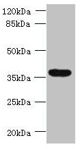 SPRYD5 Antibody - Western blot All lanes: TRIM51 antibody at 1.2µg/ml + Jurkat whole cell lysate Secondary Goat polyclonal to rabbit IgG at 1/10000 dilution Predicted band size: 53, 36 kDa Observed band size: 36 kDa