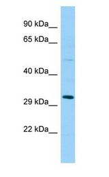 SPSB1 Antibody - SPSB1 antibody Western Blot of Fetal Lung.  This image was taken for the unconjugated form of this product. Other forms have not been tested.