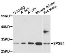 SPSB1 Antibody - Western blot analysis of extracts of various cell lines, using SPSB1 antibody at 1:1000 dilution. The secondary antibody used was an HRP Goat Anti-Rabbit IgG (H+L) at 1:10000 dilution. Lysates were loaded 25ug per lane and 3% nonfat dry milk in TBST was used for blocking. An ECL Kit was used for detection and the exposure time was 30s.