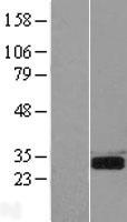 SPSB2 Protein - Western validation with an anti-DDK antibody * L: Control HEK293 lysate R: Over-expression lysate