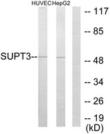 SPT3 / SUPT3H Antibody - Western blot analysis of lysates from HUVEC and HepG2 cells, using SUPT3H Antibody. The lane on the right is blocked with the synthesized peptide.