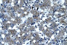 SPT3 / SUPT3H Antibody - SUPT3H / SPT3 antibody ARP30038_T100-NP_003590-SUPT3H (suppressor of Ty 3 homolog (S. cerevisiae)) Antibody IHC of formalin-fixed, paraffin-embedded human Liver. Positive label: Hepatocytes indicated with arrows. Antibody concentration 4-8 ug/ml. Magnification 400X.  This image was taken for the unconjugated form of this product. Other forms have not been tested.