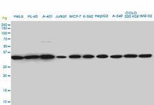 SPT3 / SUPT3H Antibody - SUPT3H monoclonal antibody (M01A), clone 1A6 Western Blot analysis of SUPT3H expression in HeLa.