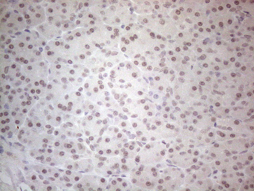 SPT3 / SUPT3H Antibody - Immunohistochemical staining of paraffin-embedded Human pancreas tissue within the normal limits using anti-SUPT3H mouse monoclonal antibody. (Heat-induced epitope retrieval by 1mM EDTA in 10mM Tris buffer. (pH8.5) at 120°C for 3 min. (1:150)