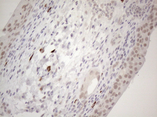 SPT3 / SUPT3H Antibody - Immunohistochemical staining of paraffin-embedded Human bladder tissue within the normal limits using anti-SUPT3H mouse monoclonal antibody. (Heat-induced epitope retrieval by 1mM EDTA in 10mM Tris buffer. (pH8.5) at 120°C for 3 min. (1:150)