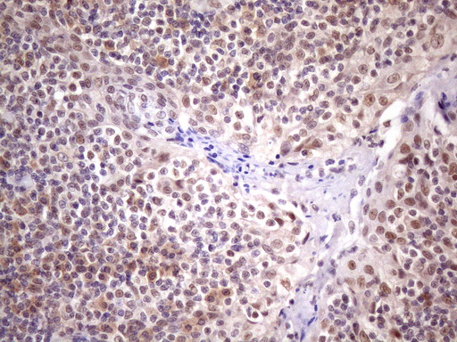 SPT3 / SUPT3H Antibody - Immunohistochemical staining of paraffin-embedded Human tonsil within the normal limits using anti-SUPT3H mouse monoclonal antibody. (Heat-induced epitope retrieval by 1 mM EDTA in 10mM Tris, pH8.5, 120C for 3min. (1:150)