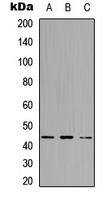 SPT3 / SUPT3H Antibody - Western blot analysis of SUPT3H expression in A431 (A); K562 (B); HL60 (C) whole cell lysates.