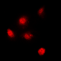 SPT3 / SUPT3H Antibody - Immunofluorescent analysis of SUPT3H staining in MCF7 cells. Formalin-fixed cells were permeabilized with 0.1% Triton X-100 in TBS for 5-10 minutes and blocked with 3% BSA-PBS for 30 minutes at room temperature. Cells were probed with the primary antibody in 3% BSA-PBS and incubated overnight at 4 deg C in a humidified chamber. Cells were washed with PBST and incubated with a DyLight 594-conjugated secondary antibody (red) in PBS at room temperature in the dark. DAPI was used to stain the cell nuclei (blue).