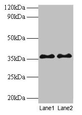 SPT3 / SUPT3H Antibody - Western blot All lanes: Transcription initiation protein SPT3 homolog at 2µg/ml Lane 1: Mouse brain tissue Lane 2: Colo320 whole cell lysate Secondary Goat polyclonal to rabbit IgG at 1/10000 dilution Predicted band size: 45, 36, 38 kDa Observed band size: 36 kDa