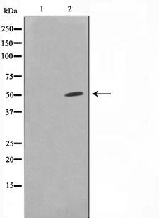 SPT3 / SUPT3H Antibody - Western blot analysis on HuvEc cell lysates using SUPT3H antibody. The lane on the left is treated with the antigen-specific peptide.