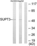 SPT3 / SUPT3H Antibody - Western blot analysis of extracts from HuvEc cells and HepG2 cells, using SUPT3 antibody.