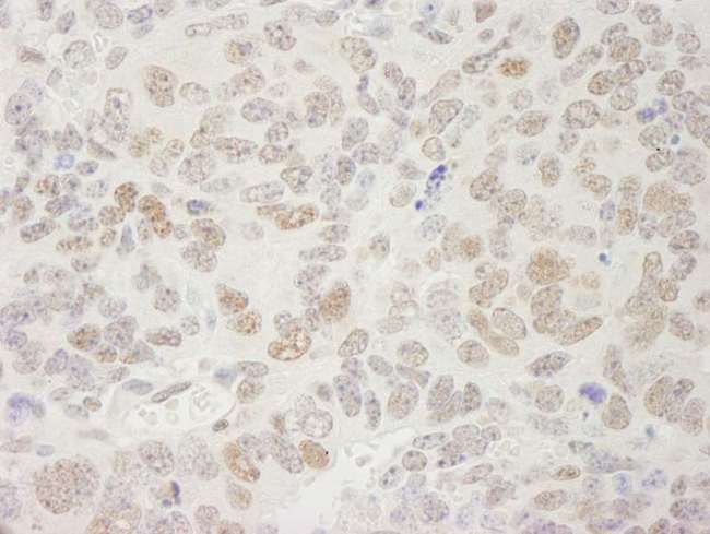 SPT5 / SUPT5H Antibody - Detection of Mouse SUPT5H by Immunohistochemistry. Sample: FFPE section of mouse teratoma. Antibody: Affinity purified rabbit anti-SUPT5H used at a dilution of 1:250.