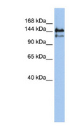 SPT5 / SUPT5H Antibody - SUPT5H antibody Western blot of Jurkat lysate. This image was taken for the unconjugated form of this product. Other forms have not been tested.