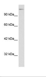 SPT5 / SUPT5H Antibody - HepG2 Cell Lysate.  This image was taken for the unconjugated form of this product. Other forms have not been tested.