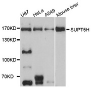 SPT5 / SUPT5H Antibody - Western blot analysis of extracts of various cell lines.