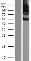 SPT5 / SUPT5H Protein - Western validation with an anti-DDK antibody * L: Control HEK293 lysate R: Over-expression lysate
